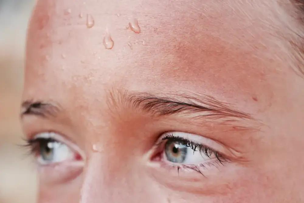 Image of a child’s sweaty forehead and face, showing signs of heat exposure and high temperatures.